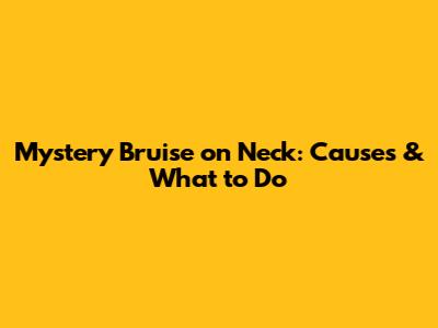 Mystery Bruise on Neck: Causes & What to Do