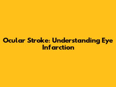 Ocular Stroke: Understanding Eye Infarction
